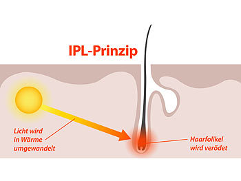 Sichler Beauty IPL Haarentfernungssystem