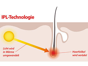 Sichler Beauty IPL-Haarentfernungs-System mit Licht-Aufsatz, Versandrückläufer