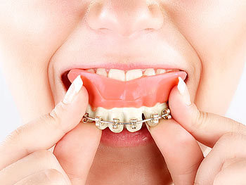 infactory Falsche Zähne mit Zahnspange