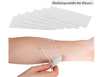 Pflaster: newgen medicals 30er-Pack medizinische Wundnahtstreifen, Klammerpflaster, 100 x 6 mm